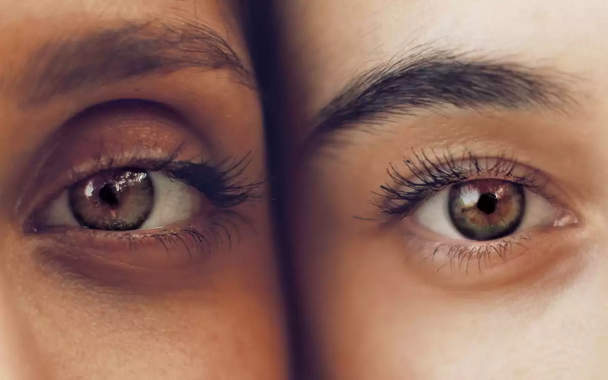 Before and after Lasik surgery